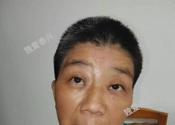 泰州市泰兴市寻亲：五旬女子被救助，穿花上衣，高1米45